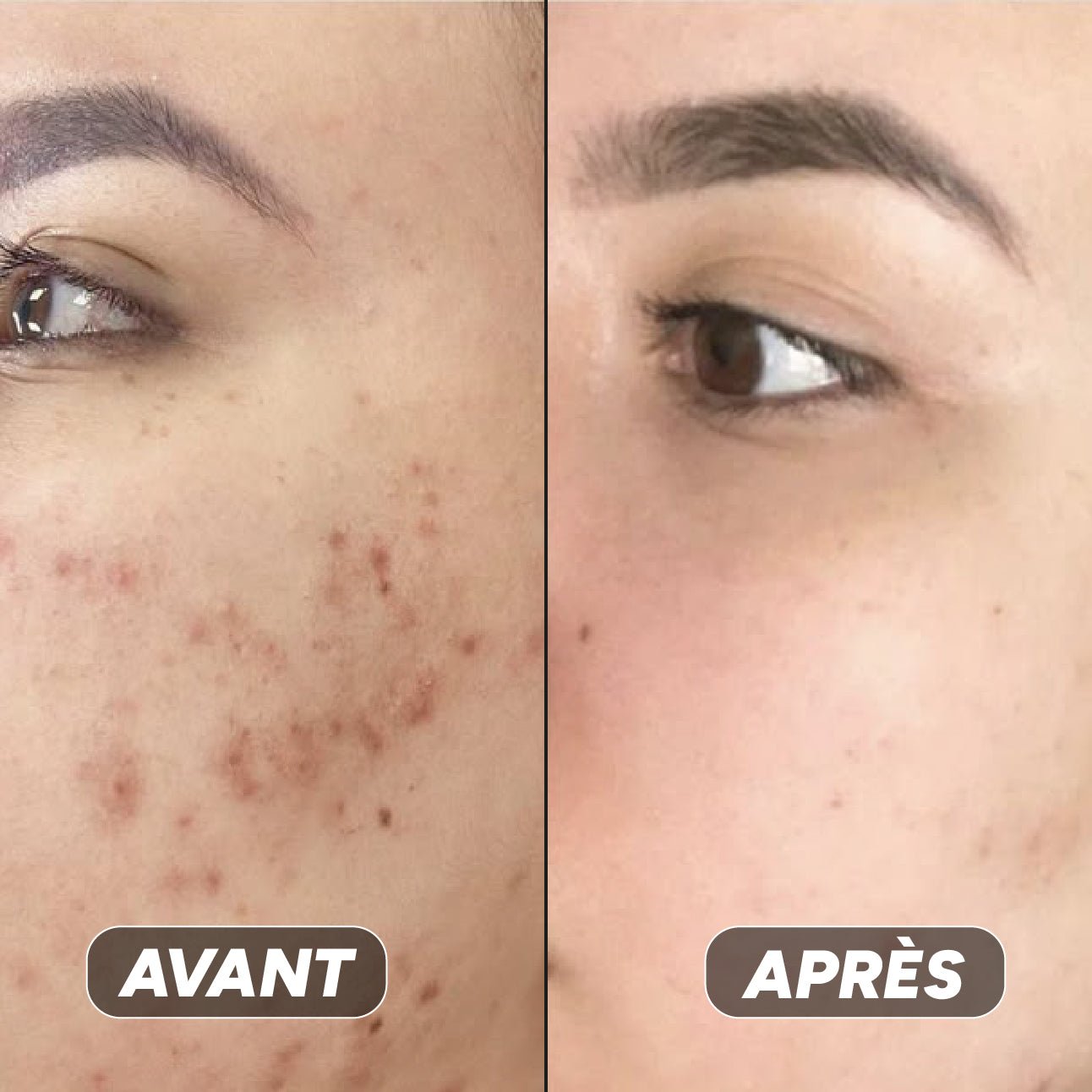 Gel Hydratant à La Niacinamide - Nuea Skin