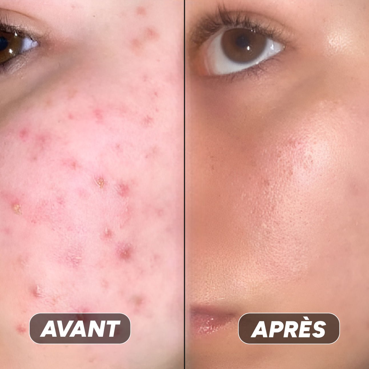 Gel Hydratant à La Niacinamide - Nuea Skin