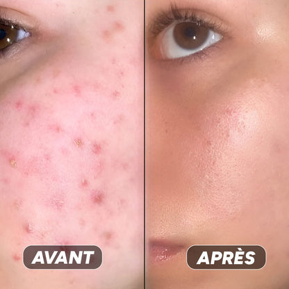 Gel Hydratant à La Niacinamide - Nuea Skin