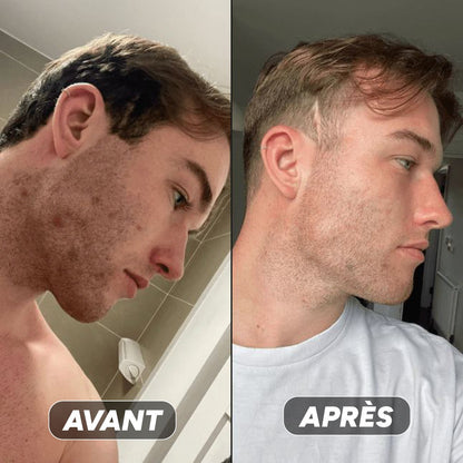 Gel Hydratant à La Niacinamide - Nuea Skin