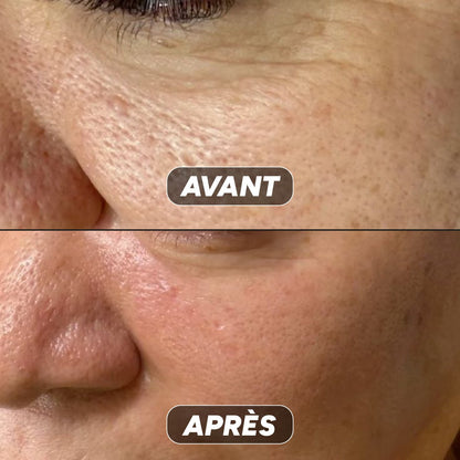 Gel Hydratant à La Niacinamide - Nuea Skin